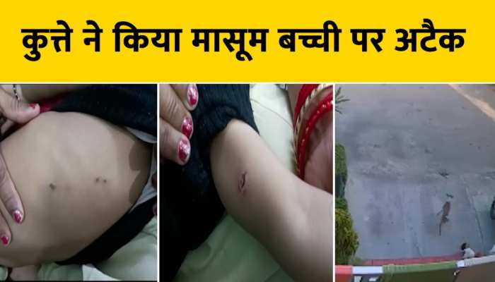 1.5 साल की मासूम पर कुत्ते ने किया हमला, देखें Video