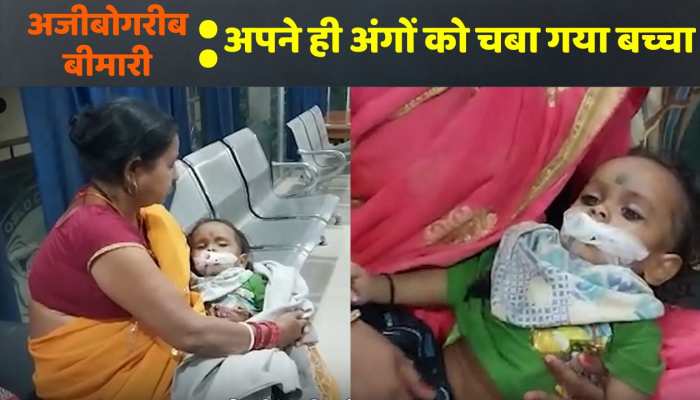 Video: बच्चे ने चबा लिया अपना ही अंग, बेगूसराय से यह दिल दहला देने वाला मामला आया सामने