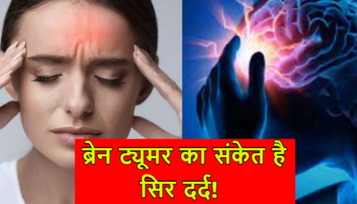 इस तरह के सिर दर्द को न करें नजरअंदाज, किसी गंभीर बीमारी के हो सकते हैं संकेत!