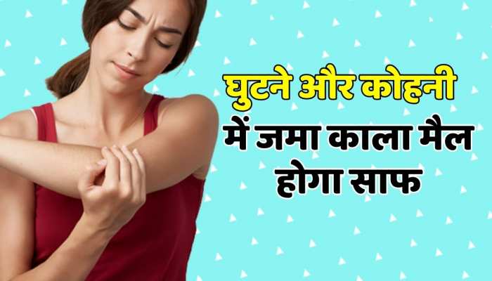Beauty tips : घुटने और कोहनी में जमा काला मैल होगा साफ बस इस्तेमाल करें ये घरेलू नुस्खा