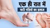 Skin Care Tips: फटी एड़ियों से पाना चाहते हैं छुटकारा, तो रोजाना दूध से करें एड़ियों की मालिश