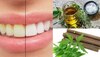 Teeth Whitening Tips:पीले दांतों से हैं परेशान, अपनाएं ये घरेलू नुस्खें, हीरे की तरह आ जाएगी शाइनिंग