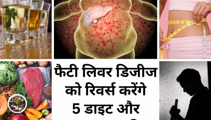 Fatty Liver Disease को रिवर्स करने में मदद करेंगे ये 5 डाइट और लाइफस्टाइल टिप्स