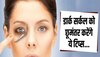 Dark Circles: आलू दूर कर देगा डार्क सर्कल्स की समस्या, बस इस तरह से करना होगा इस्तेमाल