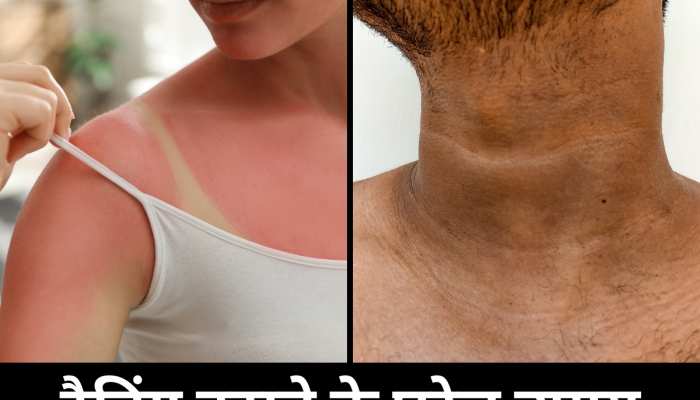 Tanning: धूप ने हाथ-पैर को कर दिया है काला? हल्दी में 2 चीजें मिलाकर दूर करें कालापन