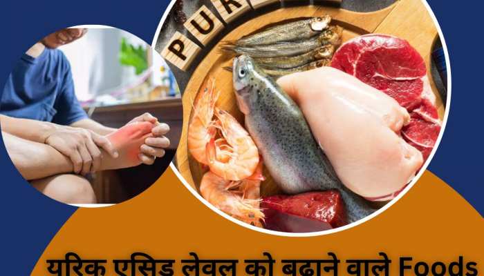 Uric Acid पेशेंट्स के दुश्मन हैं ये 5 फूड, अधिक सेवन बन सकता है पथरी का कारण!