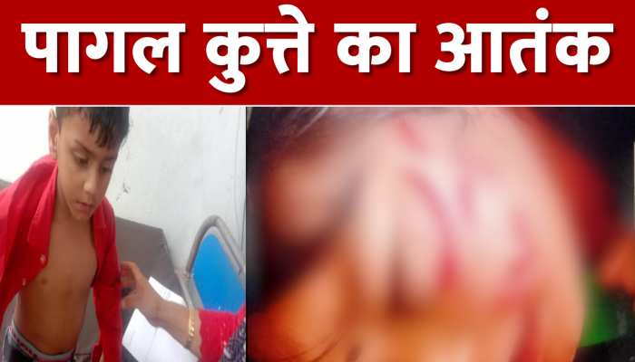 Uttarkashi: पागल कुत्ते ने कई बच्चों को बनाया अपना शिकार,2 बच्चों की हालत बेहद नाजुक