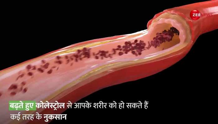 वैज्ञानिकों का दावा, Vegetarian Diet से कम होगा बढ़ता Cholesterol https://english.cdn.zeenews.com/static/apprun/fallbackimages/hindi800x400.svg