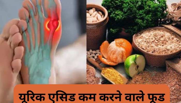 Uric Acid के बढ़ने पर न हों परेशान...बस इन पांच फूड आइटम्स को बनाएं डाइट का हिस्सा