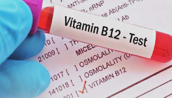 Vitamin B12 की कमी से होती हैं ये परेशानियां! जानें 10 लक्षण और 5 जबरदस्त इलाज