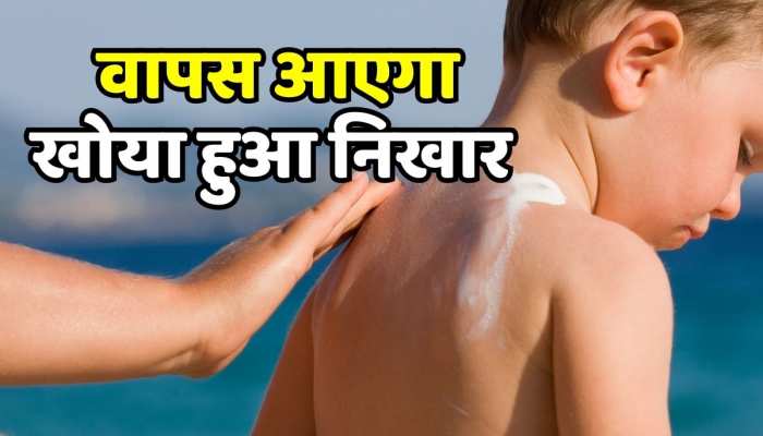 Beauty tips : चिलचिलाती धूप से खो गया स्किन का निखार तो अपनाएं ये असरदार घरेलू उपाय https://english.cdn.zeenews.com/static/apprun/fallbackimages/hindi800x400.svg