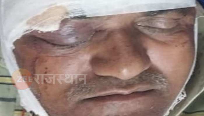 टोंक: दो कारपेंटर में हुआ जोरदार झगड़ा, ग्लेंडर से साथी कारपेंटर की काट दी जांघ