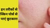 Skin Care Tips: स्किन पोर्स की वजह से चेहरा दिखता है खराब? अपनाएं ये तरीके