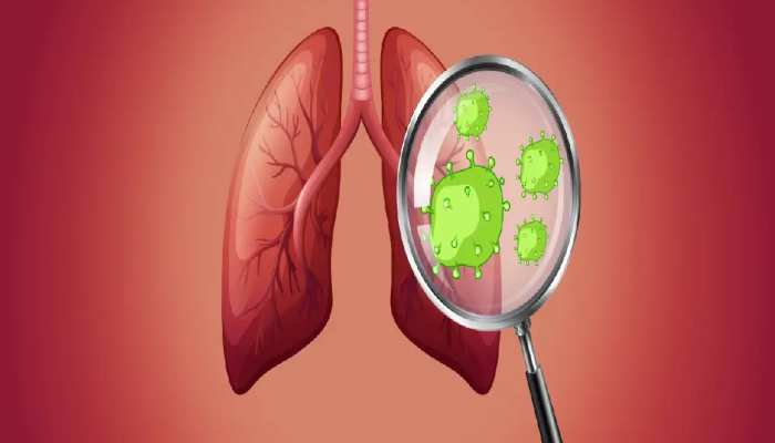 Lung cancer: लंग कैंसर से मौत का डर हो जाएगा खत्म, वैज्ञानिकों ने खोजी ये अचूक दावा!
