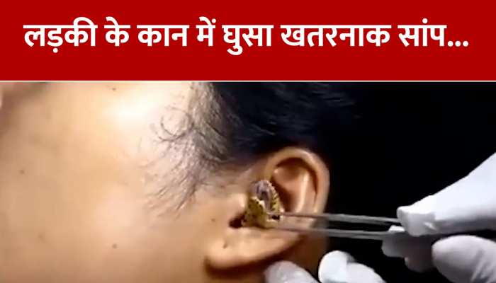 Viral Video: लड़की के कान में घुसा जहरीला सांप, फिर इस तरह निकाला गया... https://english.cdn.zeenews.com/static/apprun/fallbackimages/hindi800x400.svg