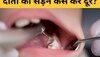 Teeth Cavity: कैविटी ने कर रखा है परेशान? दांतों को सड़न से बचाने के लिए जरूर करें ऐसे उपाय