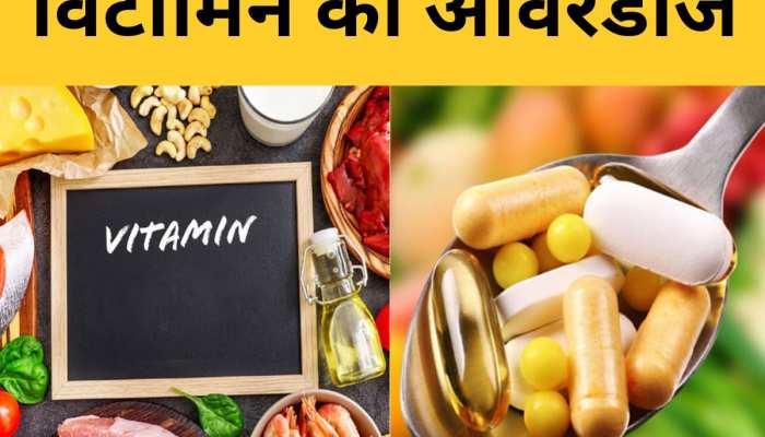 Vitamins Overdose हमारे शरीर के लिए फायदेमंद है या नुकसानदेह? डाइटीशियन से जानिए सच