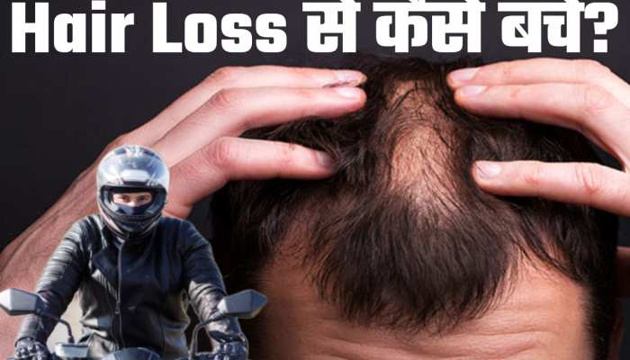 क्या Helmet पहनने से होते हैं गंजे? आधे से ज्यादा लोगों को नहीं सही जानकारी