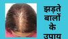 टूटते बालों से निजात दिलाएगी ये आयुर्वेदिक जड़ी-बूटी, मिलेंगे सुपर स्ट्रॉन्ग हेयर