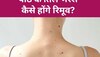 Mole on Back: पीठ पर तिल और मस्से की वजह से नहीं पहन पा रही हैं बैकलेस ड्रेस, इन चीजों से करें सफाई