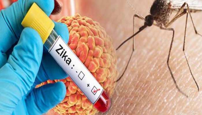 मुंबई में मिला Zika Virus का पहला केस; BMC ने कहा-'स्वयं ठीक होने वाली बीमारी'