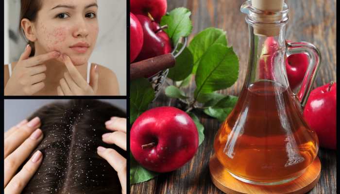 Unique Story apple cider vinegar rich in polyphenols will remove