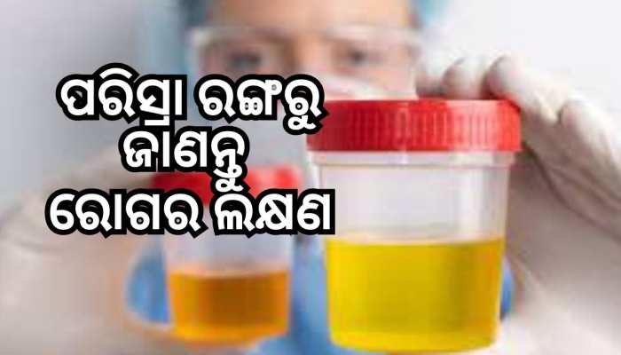 Urine And Health: ପରିସ୍ରାର ଏହି ରଙ୍ଗ ସ୍ୱାସ୍ଥ୍ୟ ପାଇଁ ସତର୍କ ଘଣ୍ଟି, ଭୁଲରେ କରନ୍ତୁନି ଅଣଦେଖ