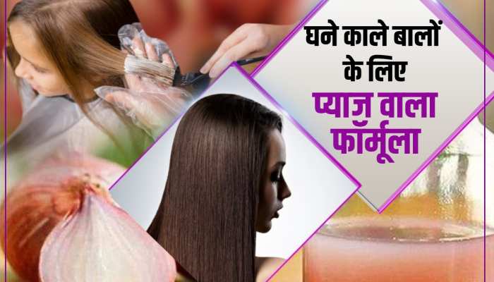 Benefits of Onion for Hair: जड़ से खत्म होगी बालों की हर समस्या, प्याज के रस में मिलाकर लगाएं ये 3 चीजें Benefits of Onion for Hair: जड़ से खत्म होगी बालों की हर समस्या, प्याज के रस में मिलाकर लगाएं ये 3 चीजें