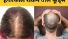 Hair Fall: बालों को टूटने से बचाएंगे ये 5 खास फूड्स, मिलेंगी लंबी और घनी जुल्फें