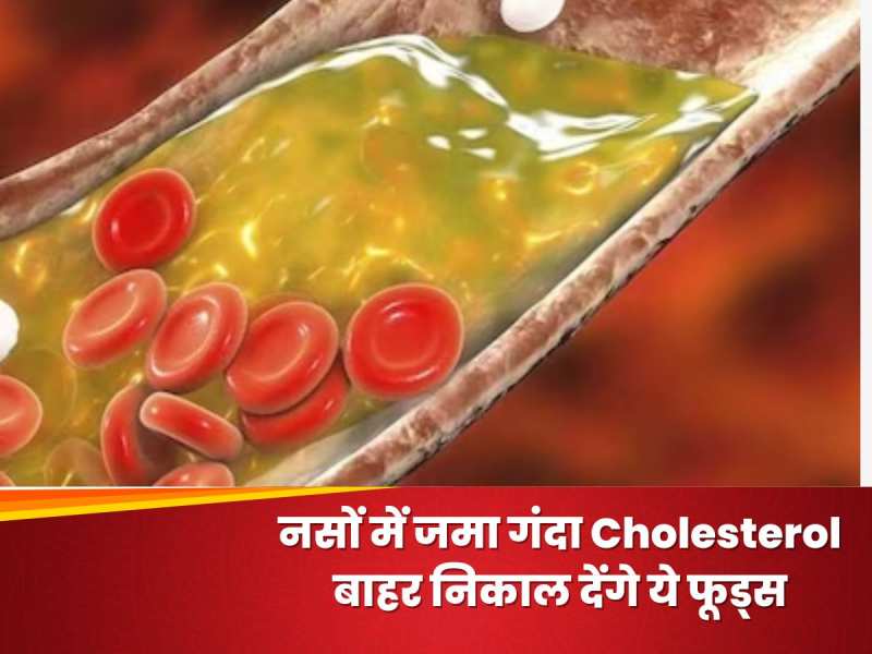 नसों में जमा गंदा Cholesterol बाहर निकाल देंगे ये फूड्स, रोजाना खाना करें शुरू