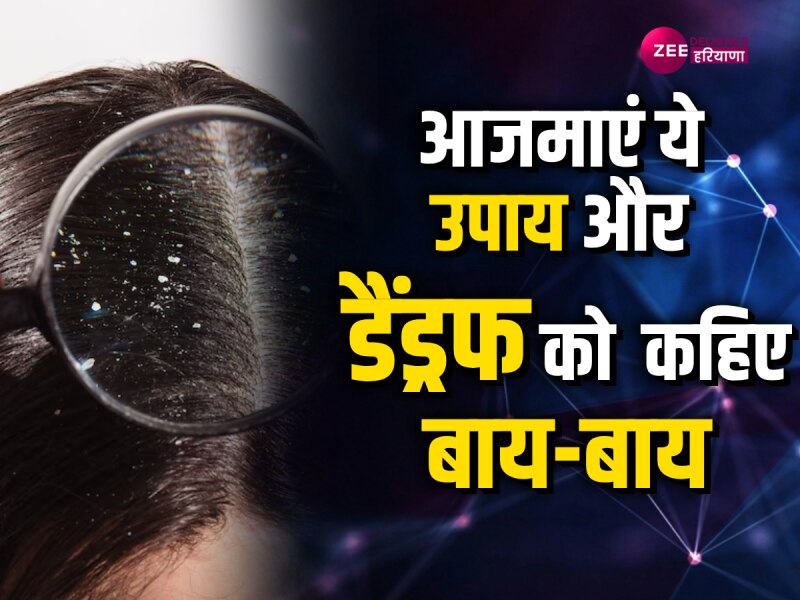 Dandruff Remedies: डैंड्रफ की वजह से बालों का हो गया है बुरा हाल तो पपीता दिखाएगा कमाल, जानें लगाने का सही तरीका Dandruff Remedies: डैंड्रफ की वजह से बालों का हो गया है बुरा हाल तो पपीता दिखाएगा कमाल, जानें लगाने का सही तरीका