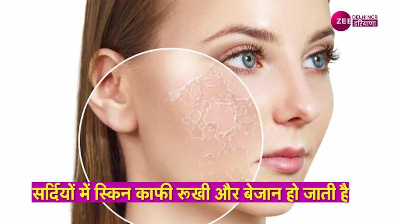 winter skin tips: क्या सर्दियों में आपकी भी चेहरा हो जाता है ड्राई, फॉलो करें ये 5 ज़रूरी टिप्स 