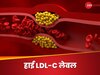 दिल के लिए बेहद खतरनाक है हाई LDL-C लेवल, जानिए किन कारणों की वजह से बढ़ता है स्तर?