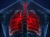 Tuberculosis Problem: फेफड़ों को खोखला करती है टीबी की समस्या, सर्दियों में रहता है इस बीमारी का सबसे ज्यादा खतरा 