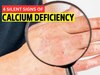 Calcium Deficiency: कैल्शियम की कमी से बिगड़ सकती है दिल धड़कने की रफ्तार, इन 4 संकेतों को न करें नजरअंदाज