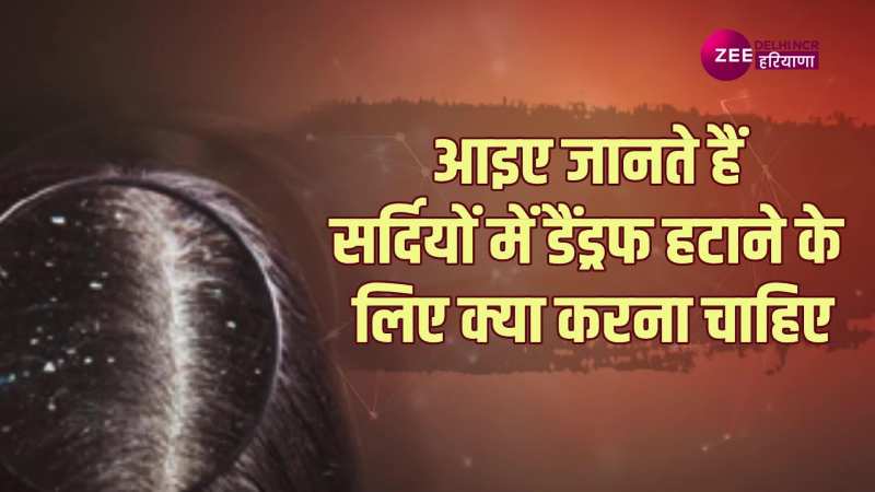 Dandruff Home Remedies:  सर्दी आते ही बालों में हो जाते हैं डैंड्रफ, इन घरेलू नुस्खे से झटपट पाएंगे छुटकारा !