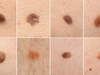 Mole On Body: इन 12 जगहों में से कहां है आपके शरीर पर तिल, जानें अपनी और दूसरों की पर्सनालिटी