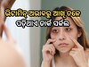 Dark circles under eyes causes and treatment