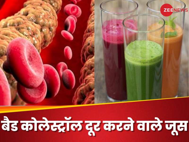 बैड कोलेस्ट्रॉल को कम करने के लिए पी सकते हैं ये 5 जूस, जानें एक्सपर्ट की सलाह