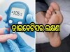 Health Tips: ଡାଇବେଟିସ୍ ରୋଗ ହେବା ପୂର୍ବରୁ ଦେଖା ଦେଇଥାଏ ଏହି ସବୁ ଲକ୍ଷଣ...