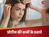 Protein Deficiency: प्रोटीन की कमी से शरीर में दिखते हैं ऐसे लक्षण, कभी न करें इग्नोर