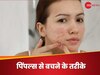 Skin Care Mistakes: इस गलतियों के कारण फेस पर आते हैं पिंपल्स, तुरंत बदले स्किन केयर रूटीन