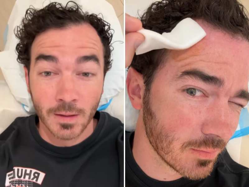 फेमस सिंगर Kevin Jonas को हुआ स्किन कैंसर, ऐसे लक्षण दिखें तो हो जाएं सतर्क