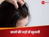 सिर में होने वाली खुजली को बढ़ा रहा है गर्मी का मौसम? इन 5 उपायों के जरिए दूर करें परेशानी