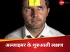 Alzheimer Disease: दिमाग को खाली कर देती है ये बीमारी, निगलना-चबाना भी भूल जाता है मरीज, डॉ. ने बताया 1st स्टेज में कैसे पहचानें