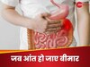 Unhealthy Gut: आंतों में खराबी आने पर शरीर में दिखते हैं ऐसे लक्षण, इग्नोर करने से बढ़ेगी परेशानी
