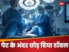 डॉक्टर ने पेट में छोड़ दिया था टॉवल, 3 महीने तक पेट दर्द से रही परेशान, वापस हॉस्पिटल गई तो...
