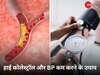 अब कोलेस्ट्रॉल और हाई ब्लड प्रेशर की नहीं रहेगी चिंता, बस मान लें डॉक्टर की ये खास सलाह