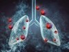 Lung Cancer अब सिर्फ स्मोकर्स की बीमारी नहीं, इन लोगों को भी ज्यादा खतरा, लैंसेट की स्टडी में सामने आई डराने वाली सच्चाई!