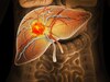 लिवर में जमते ही पिघलने लगेगा फैट, Liver Detox के लिए पिएं ये 5 ड्रिंक्स